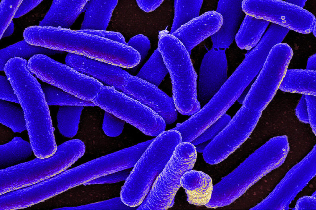 Washington part of multi-state E. coli outbreak linked to packaged