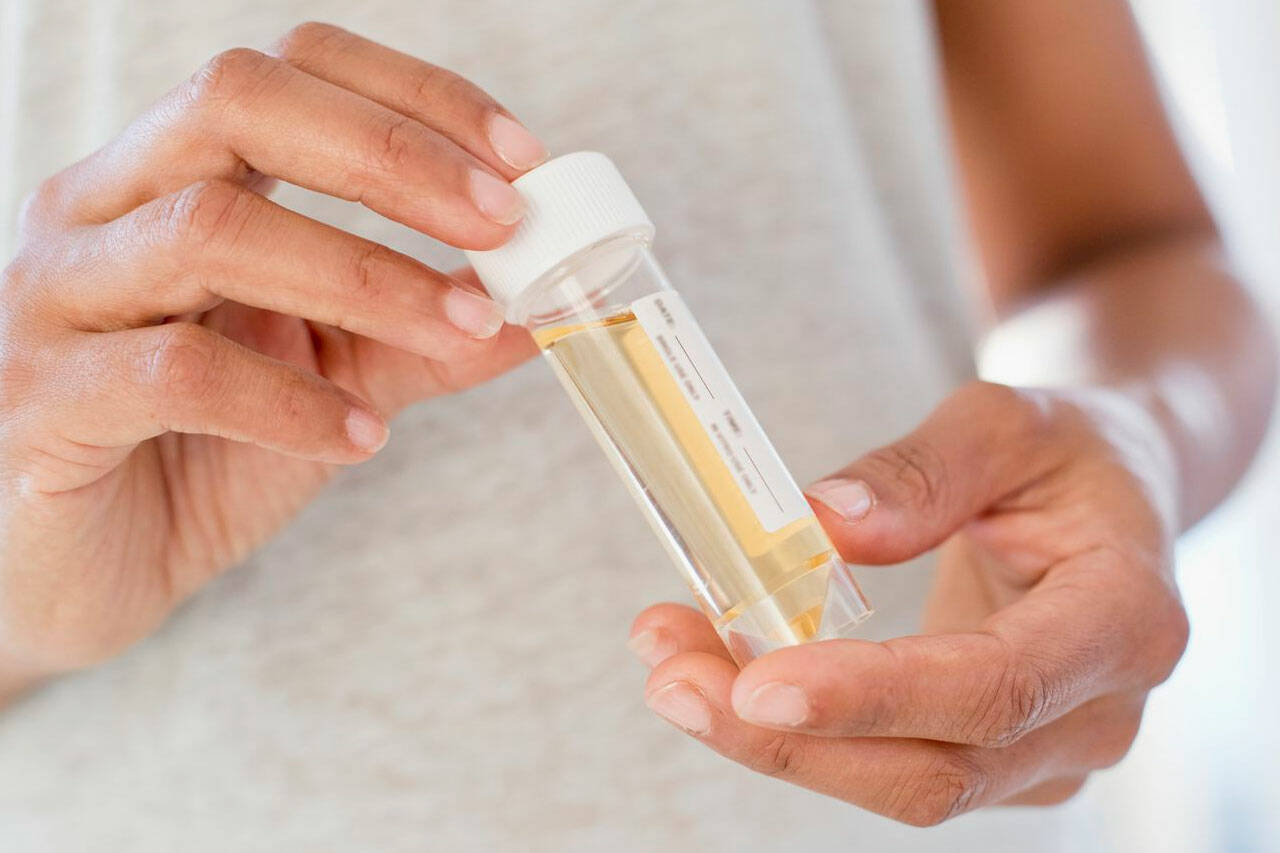 Best Synthetic Urine Kits: Top 5 Fake Pee Products to Pass a Drug Test |  Kirkland Reporter
