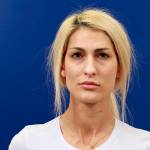 Botox thief arrested after allegedly stealing cosmetic services on Eastside